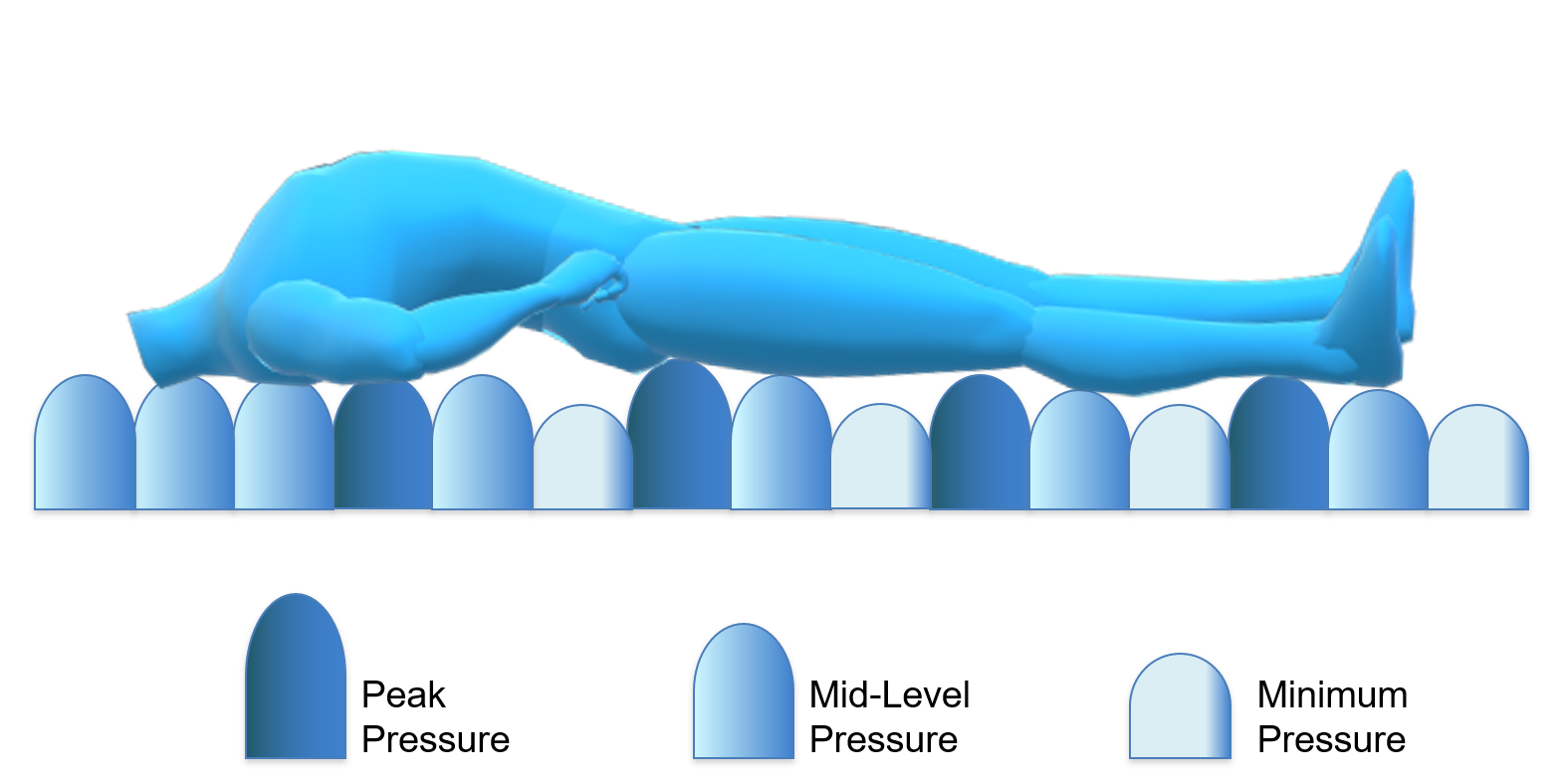 Patient supported on the True³ Digital alternating cells