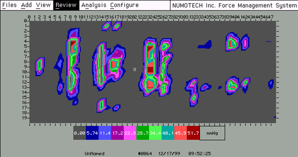 Pressure map at 5.0 minutes